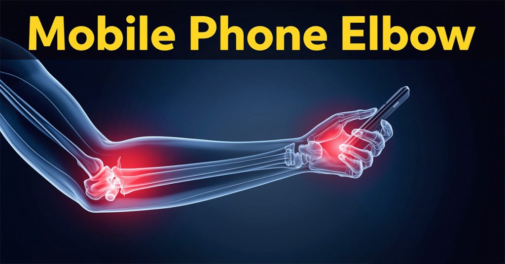 Mobile Phone Elbow